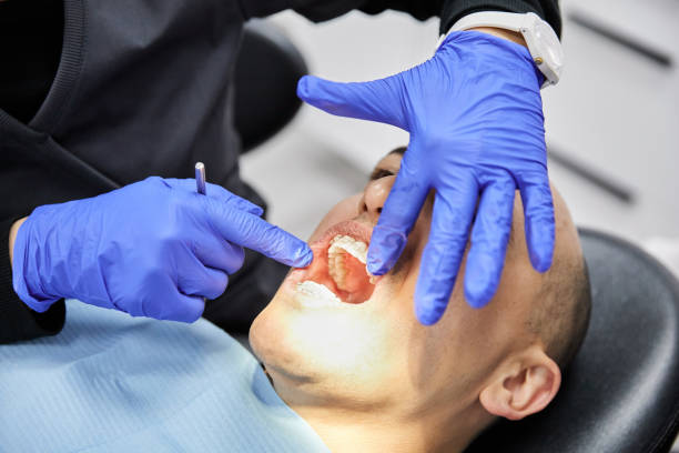 Best Emergency Tooth Extraction in Somerset, MD